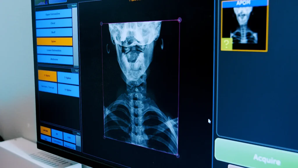Digital X-ray console screen displaying a cervical spine and chest X-ray image during a chiropractic exam