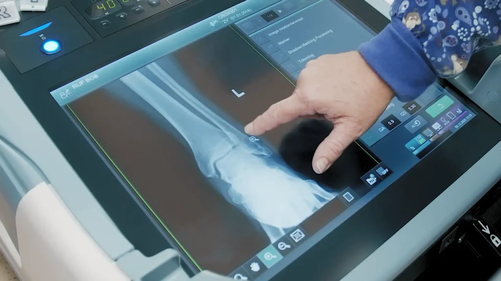 Close-up of a technologist's hand adjusting settings on a digital X-ray console displaying an ankle X-ray image