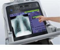 Close-up of a hand adjusting settings on the Shimadzu MX8 touchscreen control panel showing a chest X-ray
