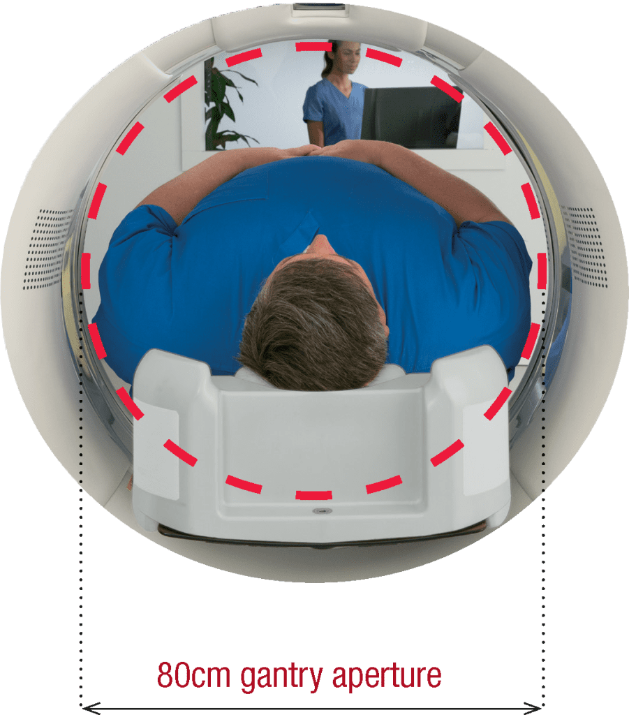 Overhead view of a patient inside the SCENARIA View Focus Edition's 80cm gantry aperture with a technologist visible in the background