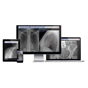 Acuity SDR+ X-ray images displayed across a desktop monitor, laptop, tablet, and phone, showing the system's multi-device viewing