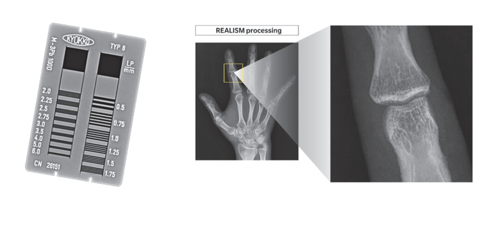 Diagram illustrating AeroDR Glassless Realism image processing, showing an X-ray resolution test card and a magnified hand X-ray detail