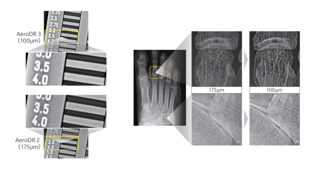 Comparison chart of AeroDR 2 (175 micron) versus AeroDR 3 (100 micron) resolution test patterns and magnified foot X-ray detail