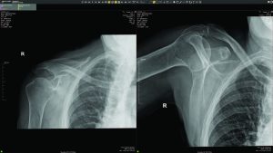 Sample shoulder X-ray images displayed in a PACS viewer, demonstrating diagnostic image output