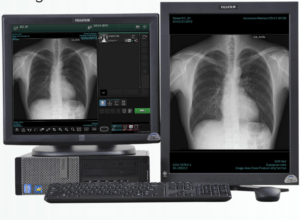 Two monitors displaying the same chest X-ray side by side on a Fujifilm FDX console workstation
