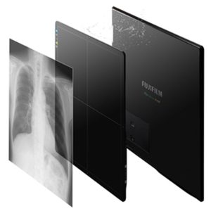 Fujifilm FDR SE Lite wireless flat panel detector with a chest X-ray image layered in front of it