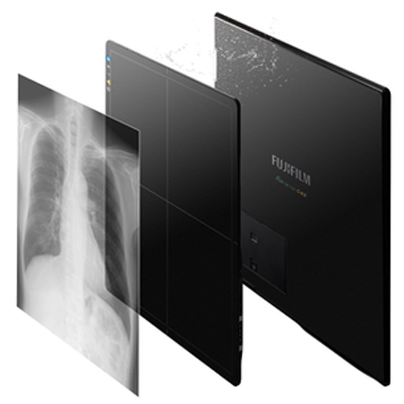 Fujifilm FDR SE Lite wireless flat panel detector with a chest X-ray image layered in front of it