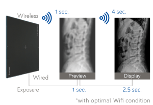 Diagram illustrating the G3 Acuity DR's faster wireless image preview and display times compared to wired transfer
