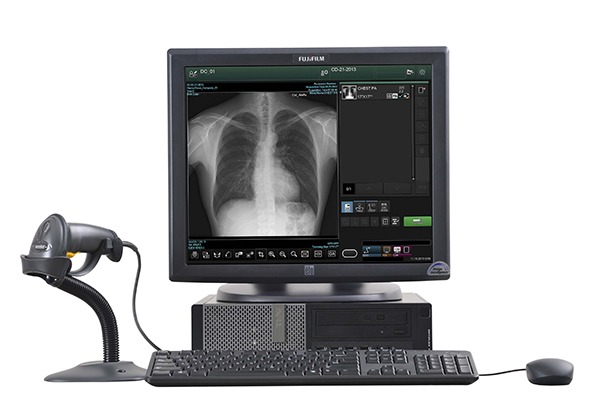 Fujifilm FDX console workstation displaying a chest X-ray, with barcode scanner, keyboard, and mouse