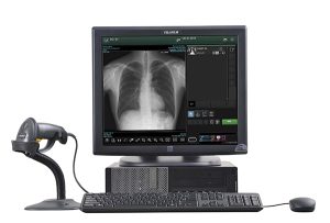 Fujifilm FDX diagnostic workstation showing a chest X-ray on the monitor with a handheld barcode scanner beside the desktop computer