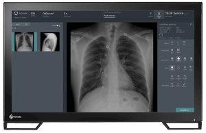 Eizo diagnostic monitor displaying a chest X-ray with image processing controls on the Persona RF PREMIUM console