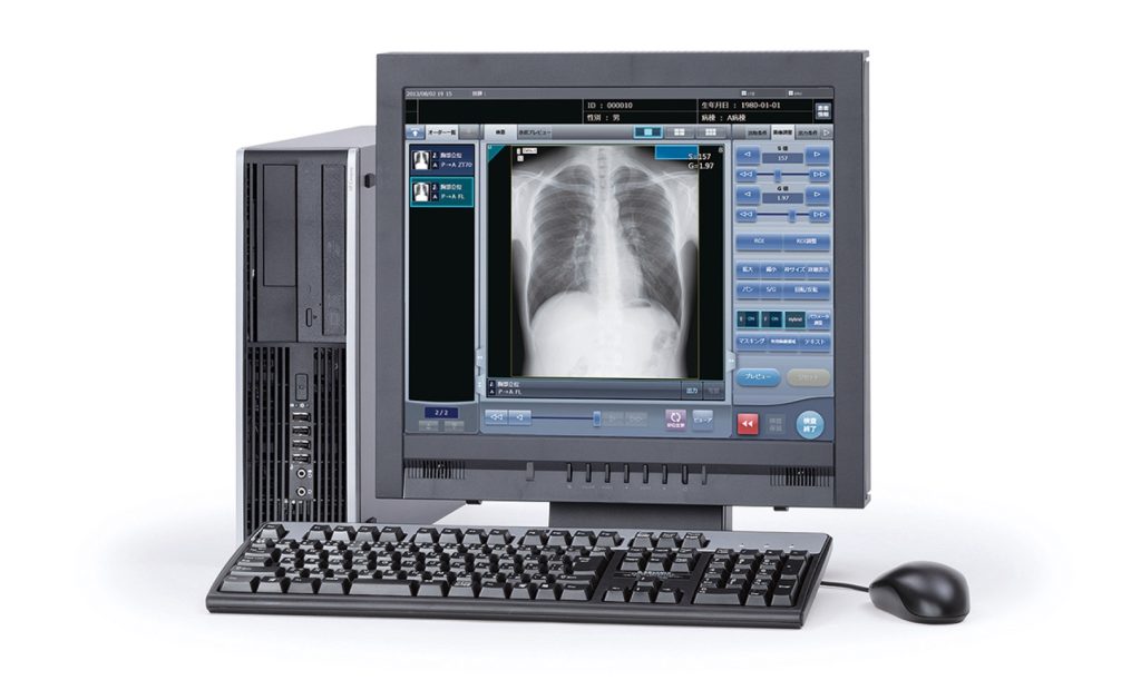 Computer workstation displaying a chest X-ray in a PACS viewer software interface