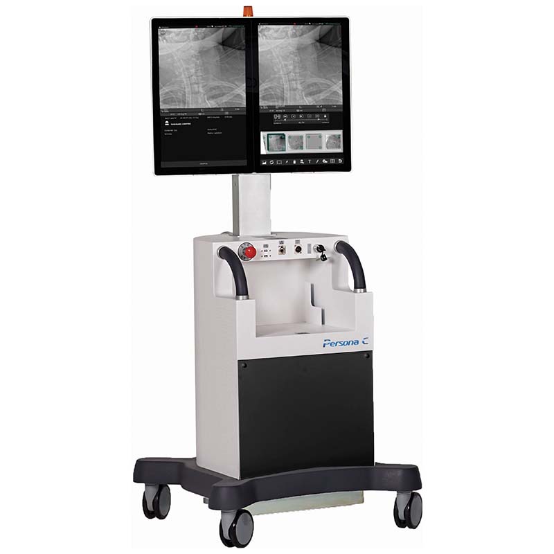 Persona C mobile C-arm system console with dual monitors displaying spine fluoroscopy images