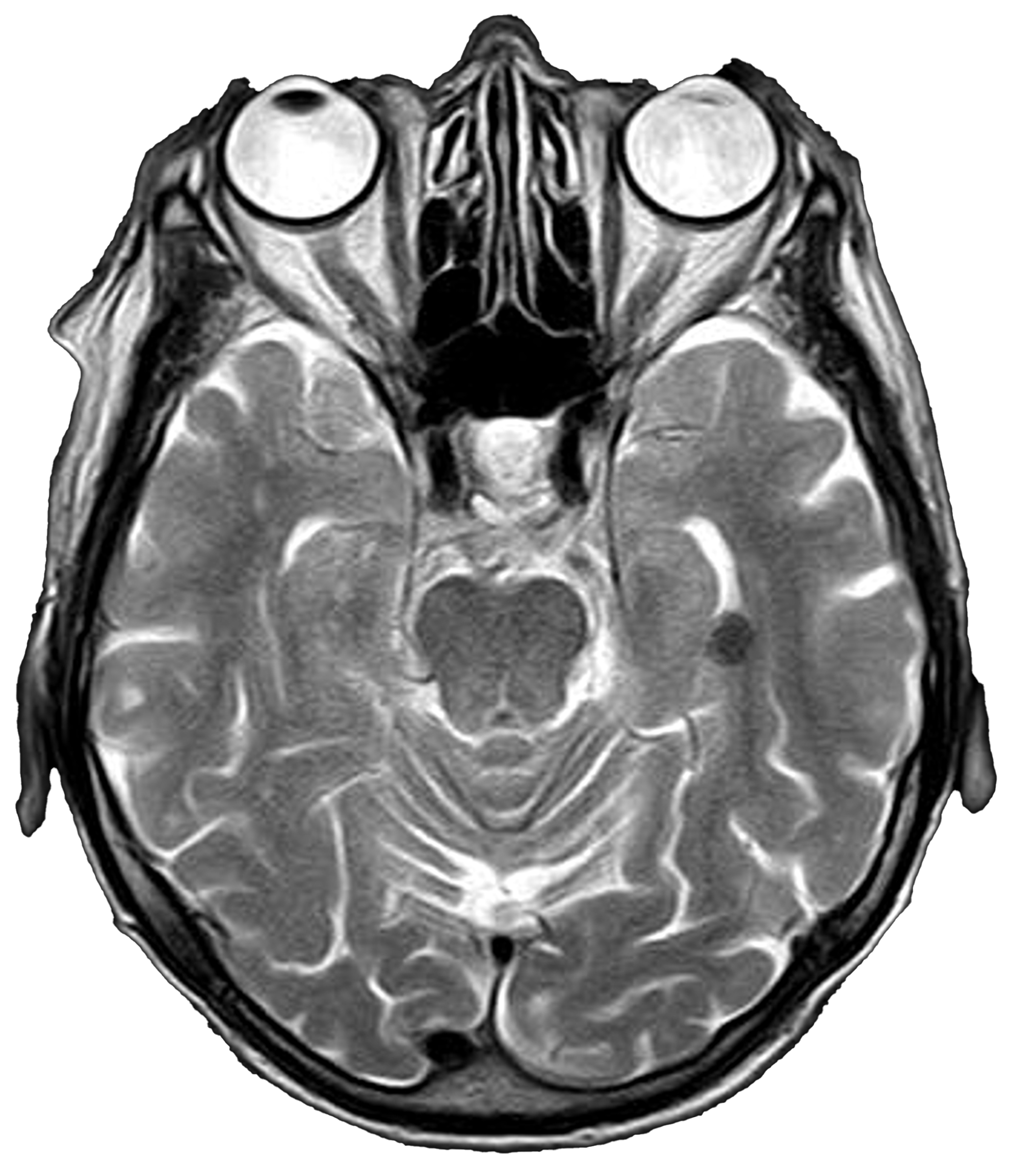 SwiftMR® AI-Powered MRI - BMI | MRI Artificial Intelligence