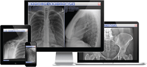 Illustration of DICOM chest and pelvis X-ray images displayed across a desktop monitor, tablet, and smartphone, representing wireless image viewing (note: this image depicts general multi-device viewing, not the Acuity SDR+ unit itself)