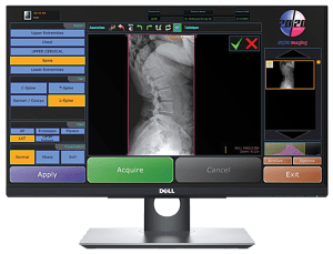 20/20 Imaging acquisition software interface on a Dell touchscreen monitor showing a lumbar spine X-ray and positioning controls