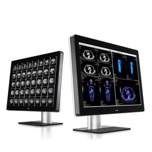 Two diagnostic monitors displaying CT and PET/CT images side by side