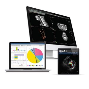 Exa-PACS software shown across a desktop monitor, laptop, and tablet displaying CT, dashboard analytics, and echocardiogram images