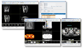 Multiple RemotEye Suite viewer windows displaying CT and other DICOM images