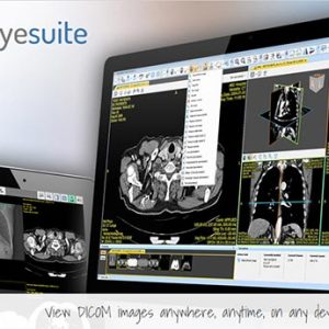 RemotEye Suite branding graphic showing DICOM images displayed on desktop and tablet screens