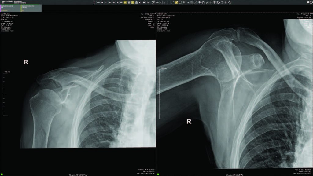 Sample shoulder X-ray images displayed in a PACS viewer, demonstrating diagnostic image output from the KDR Advanced U-Arm System