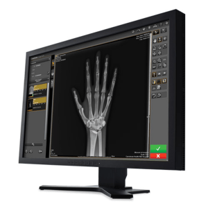 Carestream Image Suite workstation monitor displaying a hand X-ray with approve/reject controls