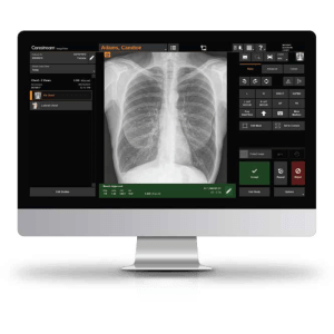 Carestream ImageView software exam screen showing a PA chest positioning diagram and exposure technique settings