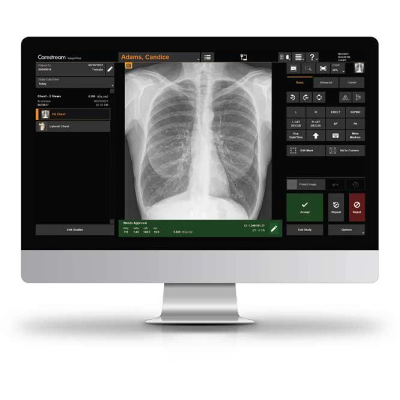 ImageView Software - BMI