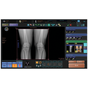 Ultra DR software interface showing a standing knee X-ray with exposure settings and thumbnail image gallery