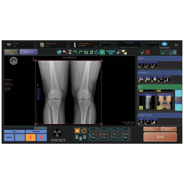Ultra Software Ultra DR Software - BMI