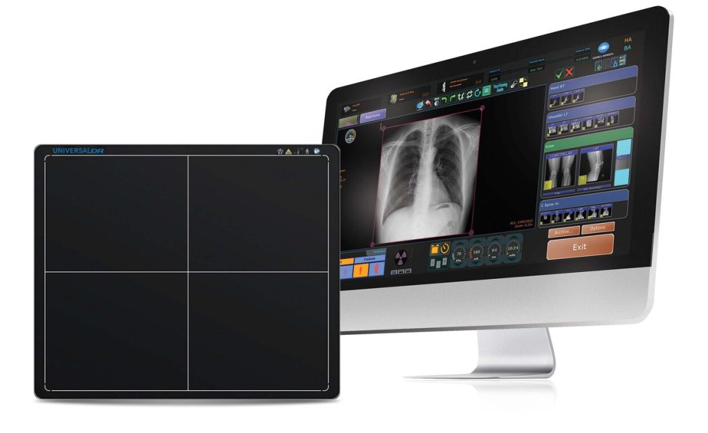 Universal DR flat panel detector paired with a monitor displaying the Ultra DR imaging software and a chest X-ray