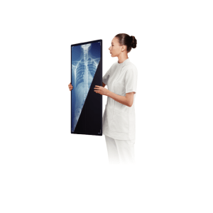 Clinician in scrubs holding and reviewing an FDR D-EVO III G80i wireless flat panel detector displaying a chest X-ray