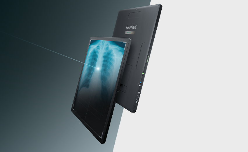 Fujifilm FDR ES II detector panel shown at an angle displaying a chest X-ray image on its integrated screen