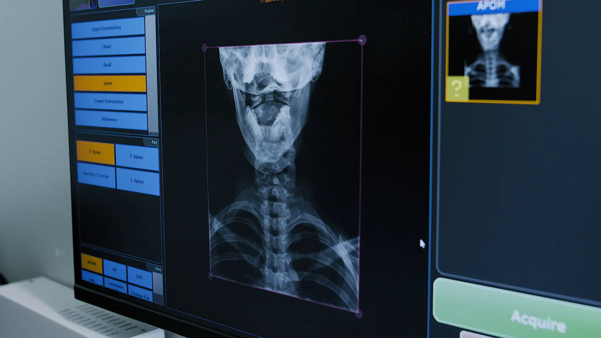 X-ray imaging software screen displaying a cervical spine radiograph with region and view selection menus