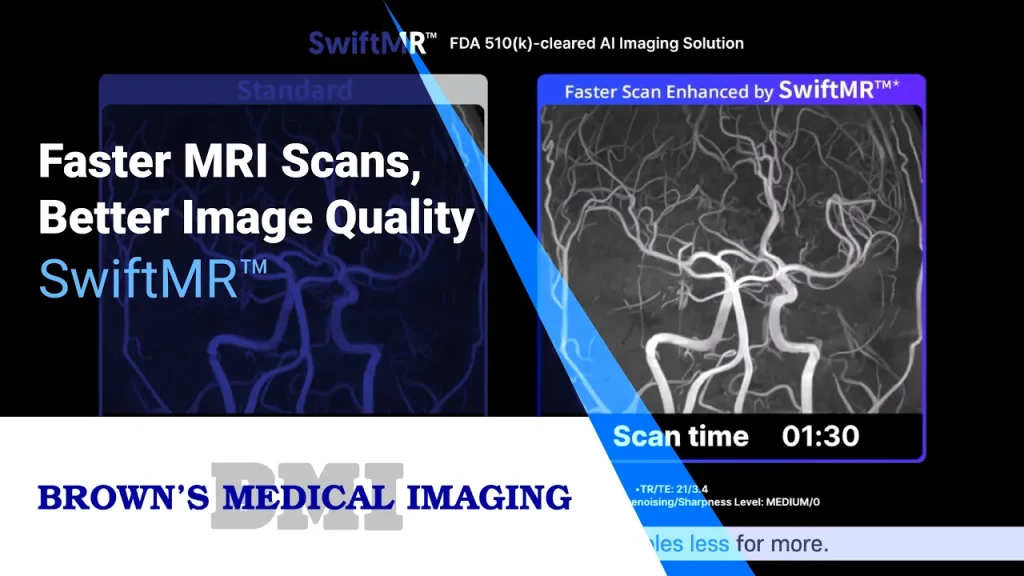 Video thumbnail comparing standard and SwiftMR-enhanced MRI angiography scans, showing faster scan time
