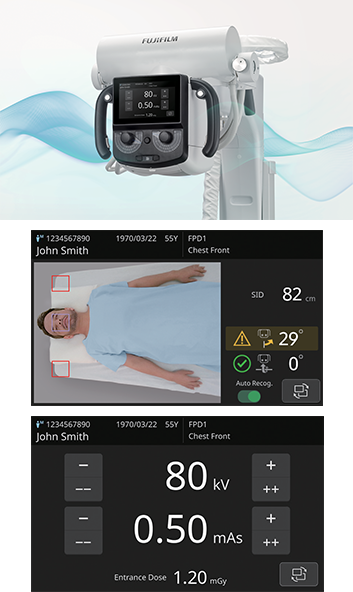 FDR Go iQ tube head positioning interface showing exposure settings and patient positioning guidance on screen