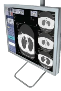 Diagnostic monitor displaying multiple CT chest scan images including axial cross-sections and a timer readout