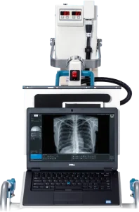 iQ Flex-M portable X-ray system with generator head positioned above a laptop displaying a chest X-ray in viewing software