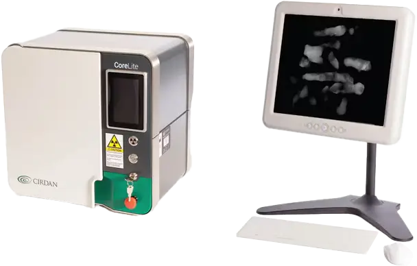 CoreLite bone densitometer scanner unit next to a display monitor showing a scanned bone image on a stand