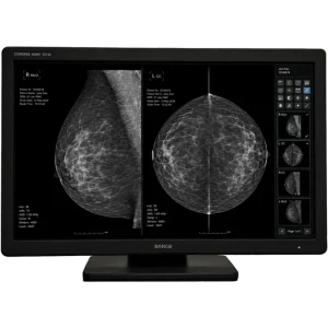 Barco Coronis diagnostic mammography monitor displaying bilateral breast imaging views