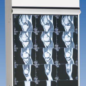 Trimline Basic Illuminator Series 2 Bulb Illumination - Automatic Switchng, No Leakage, Instant Ball