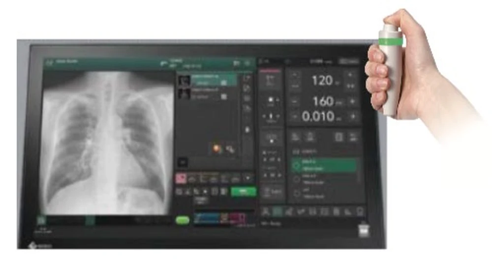 FDR Visionary Suite integrated acquisition console showing a chest image and exposure settings