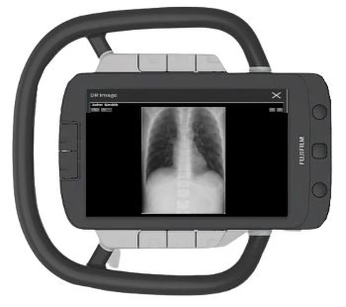 Image preview of a chest radiograph on the FDR Visionary Suite tube head display